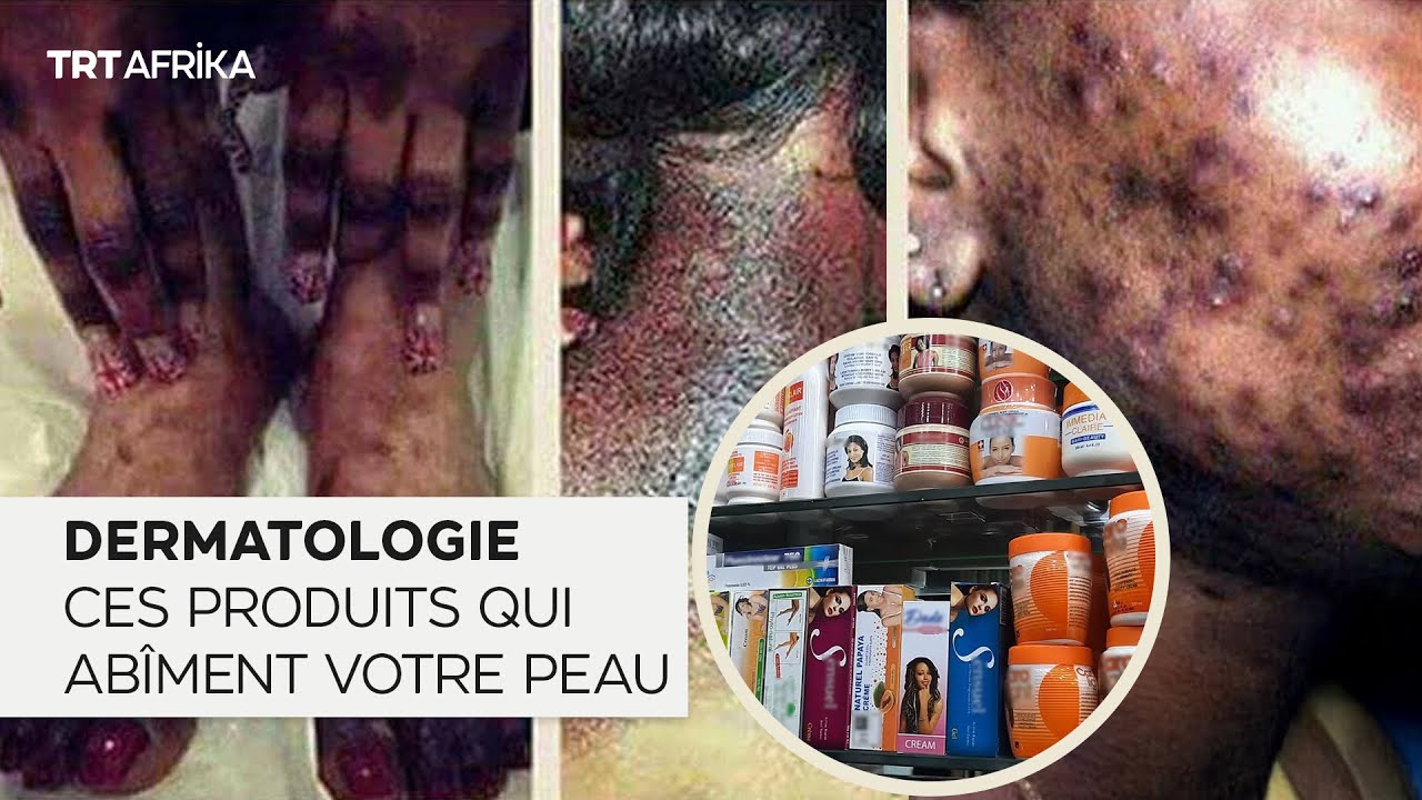 découvrez les nouvelles mesures concernant l'interdiction partielle du tabac aux maldives, visant à protéger la santé publique tout en respectant les spécificités locales.